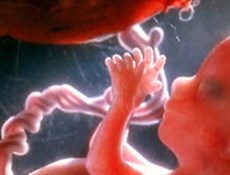 بررسی ناهنجاری های جنین بر روی ۱۰ هزار و ۳۰۰ مادر باردار