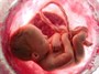"غربالگری" طرحی برای رسمیت‌بخشیدن به مجوزهای غیرشرعی "سقط جنین" + پاسخ استفتائات