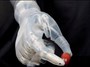 دست مصنوعی هوشمند در ایران ساخته شد
