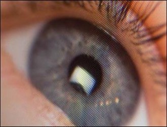 ارتباط قرارگیری در معرض نورخورشید و کاهش ابتلا به نزدیک بینی