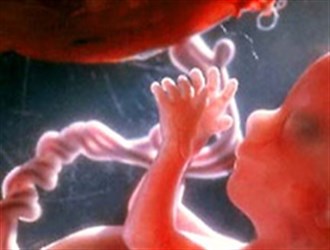 "سقط جنین" به‌صرف داشتن "مجوز قانونی بر اساس غربالگری" جایز نیست!