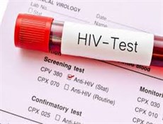 هر بیمار HIV سالانه 14 تا 16 هزار دلار هزینه دارد