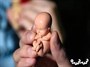 ۲۱۴۹ مجوز سقط درمانی در سه ماهه اول امسال صادر شد