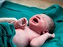 علت تولد نوزاد سندرم داون/شایع ترین ناهنجـاری کروموزومـی
