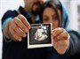پاسخ وزارت بهداشت به گزارشی درباره بارداری ایمن