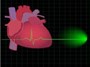 التهاب عضله قلب چیست؟