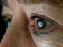ژن درمانی به کمک نابینایی آمد/ هزینه ۸۰۰ هزار دلاری