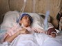800 هزار معلول حاصل چهار دهه جنگ در افغانستان