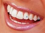 در مورد کاشت نگین دندان چه می دانید