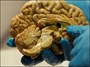 مغز معتادان دچار تغییرات ژنتیکی می‌شود