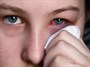درمان عفونت چشم در اثر گذاشتن لنز چشم